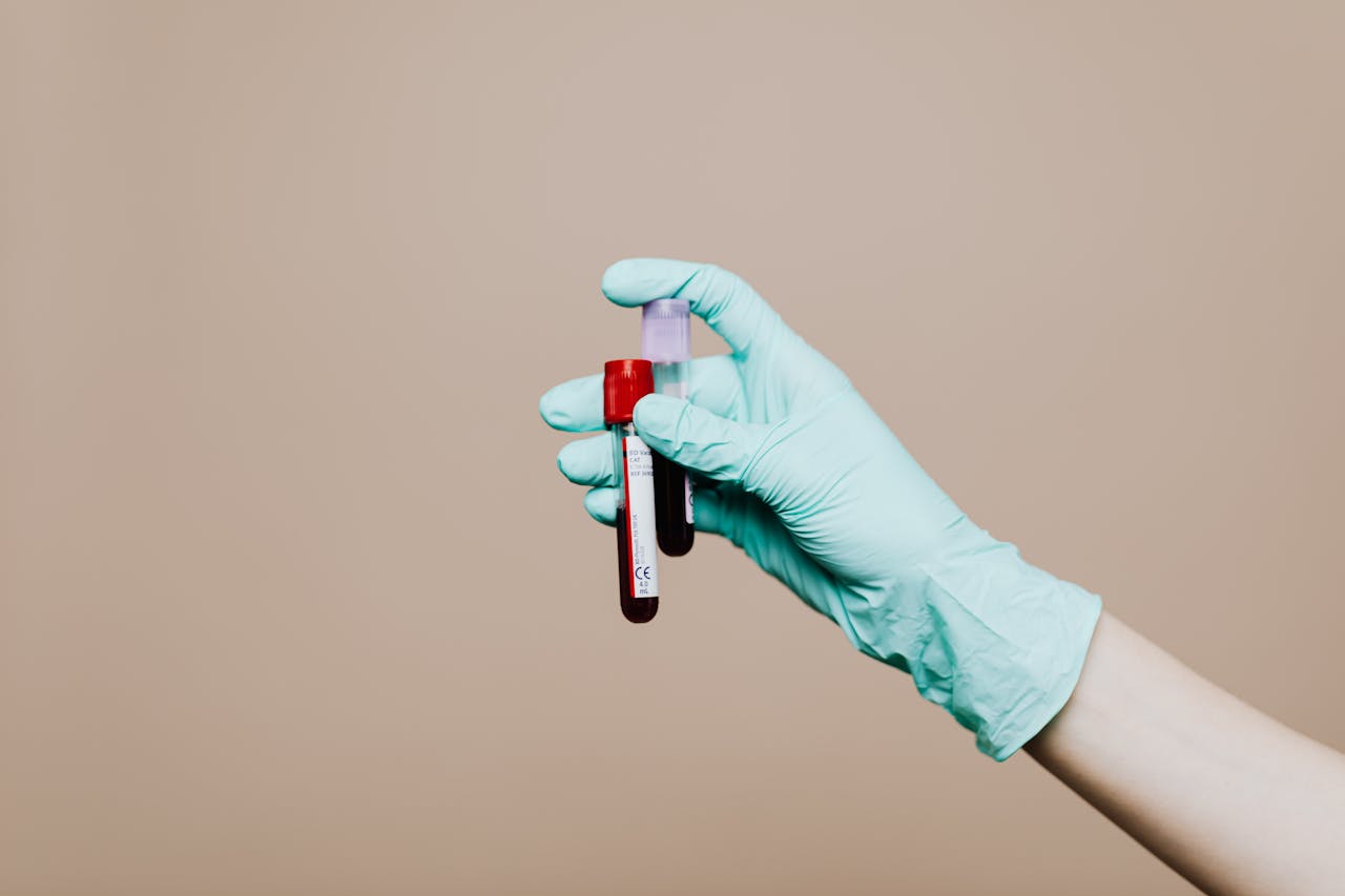 Blood Tests