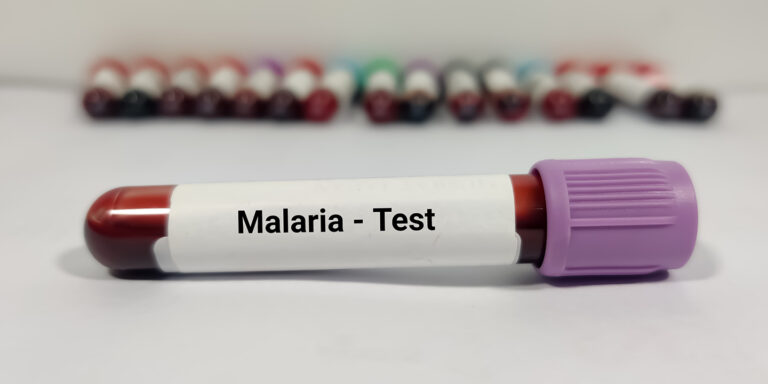 How to Test for Malaria: A Step-by-Step Guide