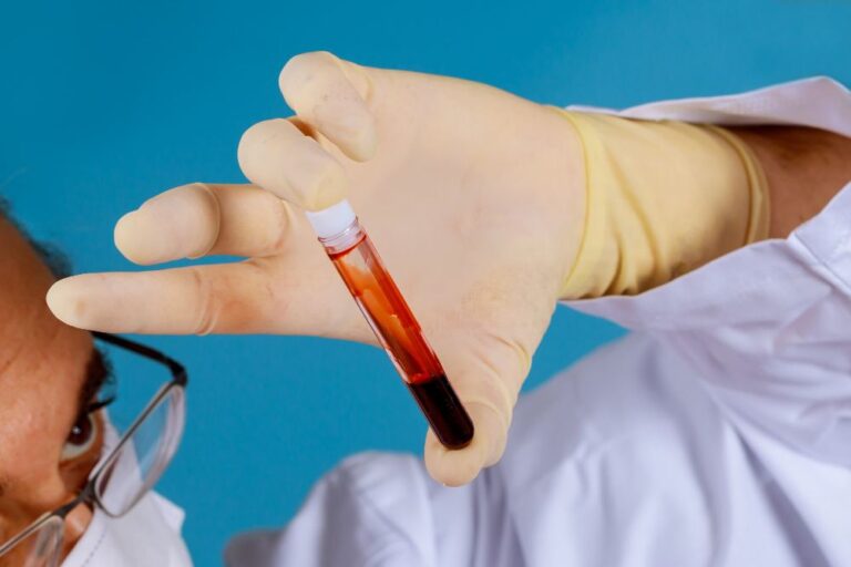 Blood Tests That Help Identify the Cause of Fever