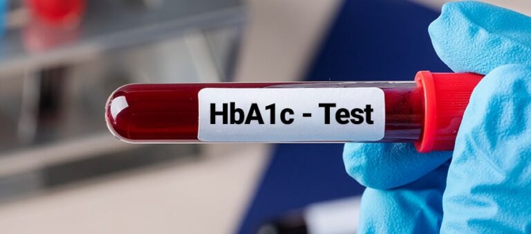 What Is an HbA1c Test and Why It’s Crucial for Diabetes Management