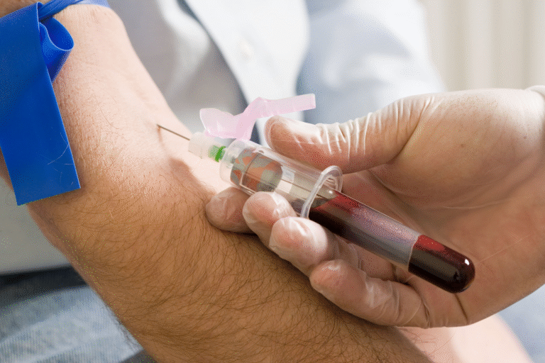 How Is Prostate Cancer Detected with a Blood Test?
