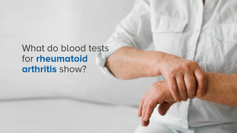 Why Blood Tests Are Important in Detecting Rheumatoid Arthritis